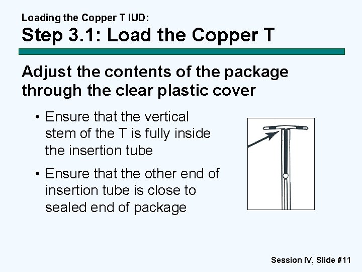Loading the Copper T IUD: Step 3. 1: Load the Copper T Adjust the Loading the Copper T IUD: Step 3. 1: Load the Copper T Adjust the