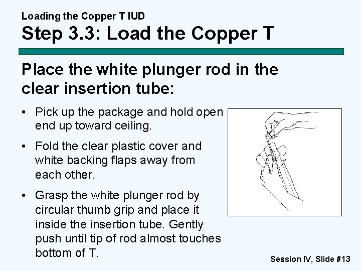 Loading the Copper T IUD Step 3. 3: Load the Copper T Place the