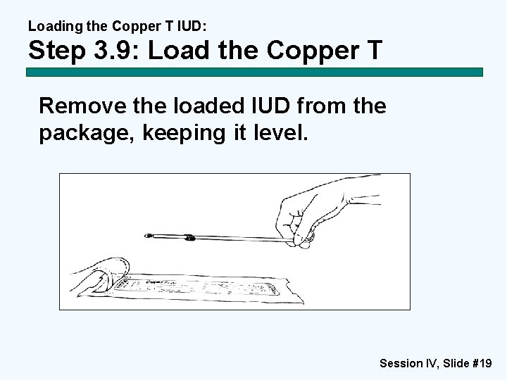 Loading the Copper T IUD: Step 3. 9: Load the Copper T Remove the