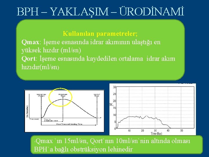 BPH – YAKLAŞIM – ÜRODİNAMİ Kullanılan parametreler; Qmax: İşeme esnasında idrar akımının ulaştığı en