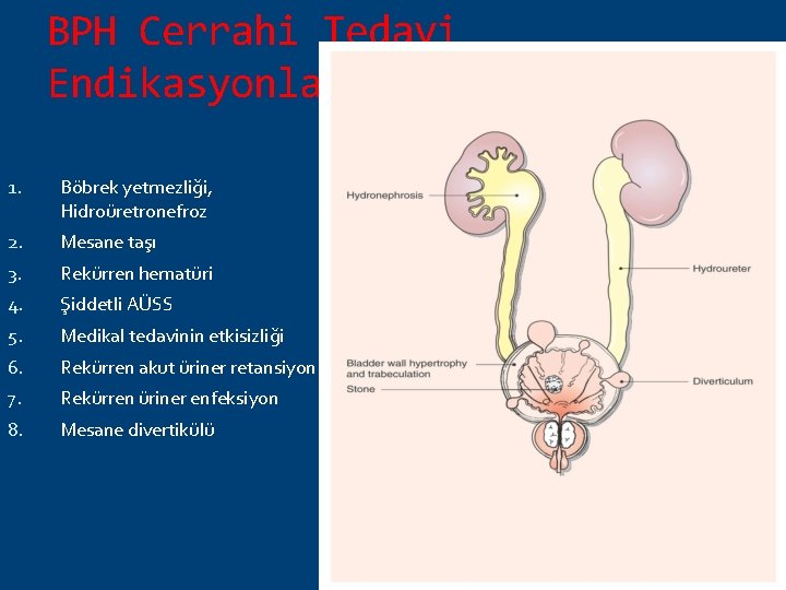 BPH Cerrahi Tedavi Endikasyonları 1. Böbrek yetmezliği, Hidroüretronefroz 2. Mesane taşı 3. Rekürren hematüri