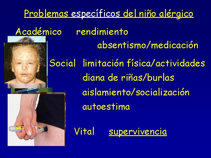 Problemas específicos del niño alérgico Académico rendimiento absentismo/medicación Social limitación física/actividades diana de riñas/burlas