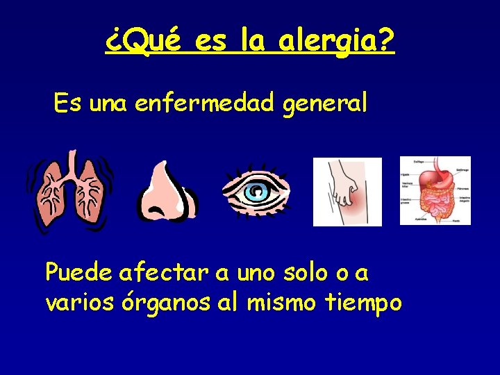 ¿Qué es la alergia? Es una enfermedad general Puede afectar a uno solo o