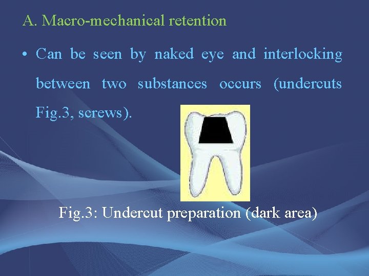 A. Macro-mechanical retention • Can be seen by naked eye and interlocking between two