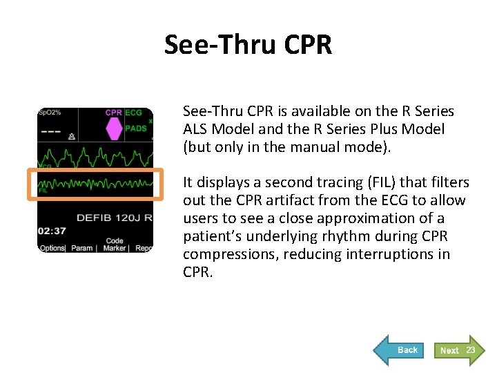 See-Thru CPR is available on the R Series ALS Model and the R Series