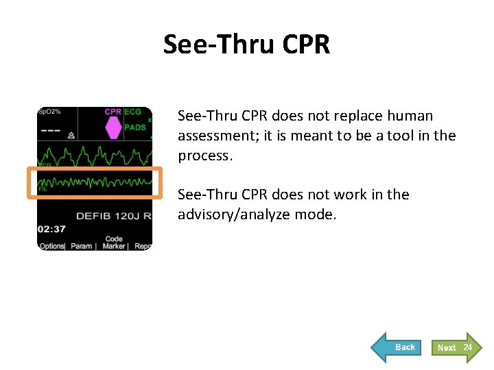 See-Thru CPR does not replace human assessment; it is meant to be a tool
