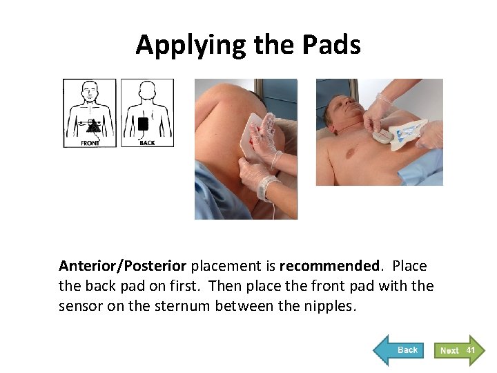 Applying the Pads Anterior/Posterior placement is recommended. Place the back pad on first. Then Applying the Pads Anterior/Posterior placement is recommended. Place the back pad on first. Then