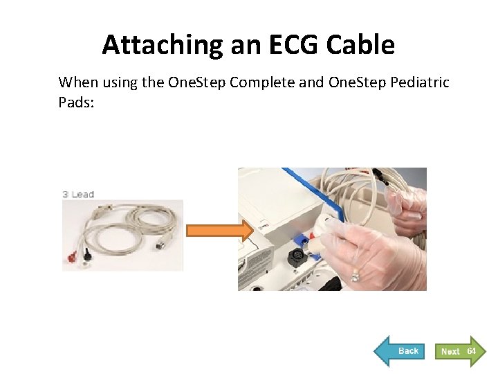 Attaching an ECG Cable When using the One. Step Complete and One. Step Pediatric Attaching an ECG Cable When using the One. Step Complete and One. Step Pediatric