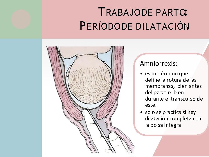 T RABAJO DE PARTO: P ERÍODO DE DILATACIÓN. Amniorrexis: • es un término que