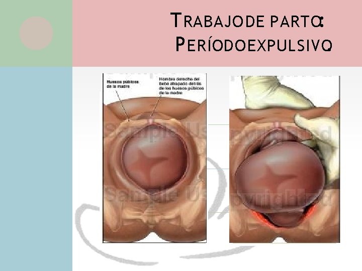 T RABAJO DE PARTO: P ERÍODO EXPULSIVO. Fenómenos que se producen: Se entreabre la