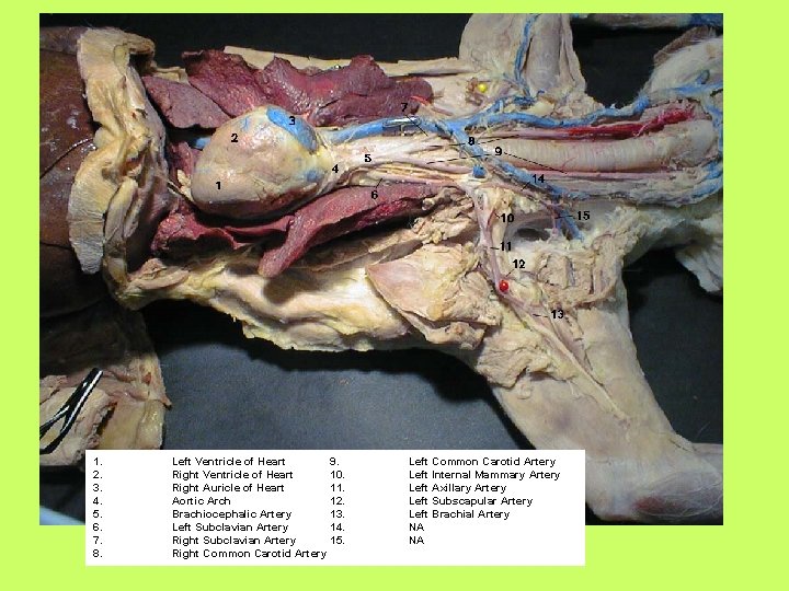 1. 2. 3. 4. 5. 6. 7. 8. Left Ventricle of Heart 9. Right