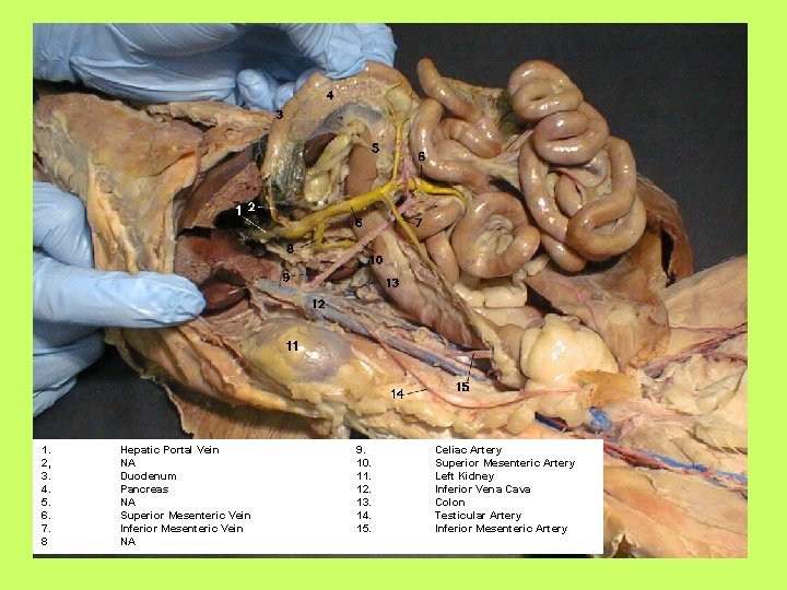 1. 2, 3. 4. 5. 6. 7. 8 Hepatic Portal Vein NA Duodenum Pancreas