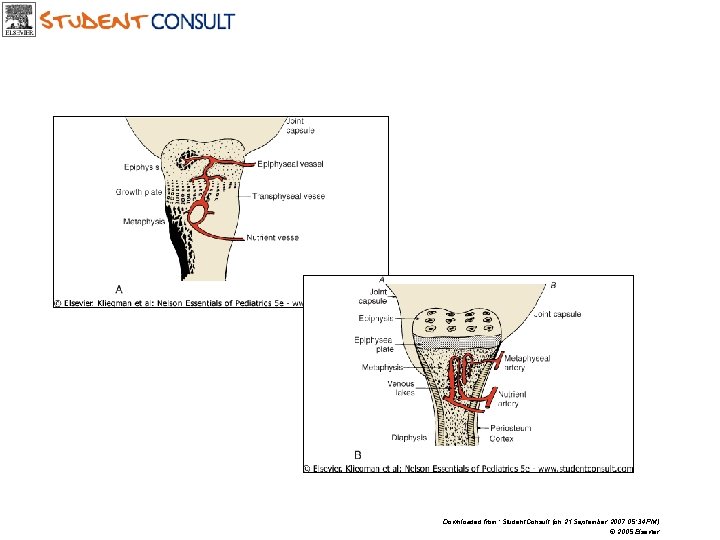 Downloaded from: Student. Consult (on 21 September 2007 05: 34 PM) © 2005 Elsevier