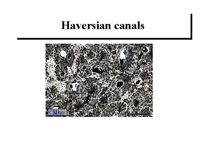 Haversian canals 