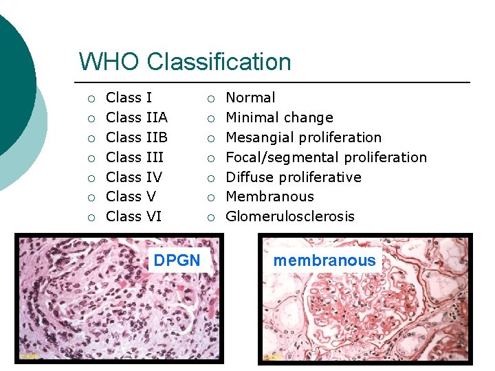 WHO Classification ¡ ¡ ¡ ¡ Class Class I IIA IIB III IV V