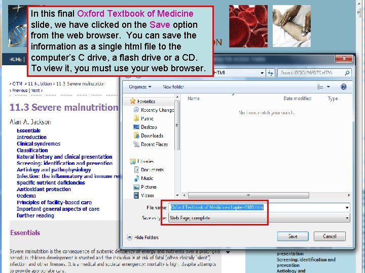In this final Oxford Textbook of Medicine slide, we have clicked on the Save