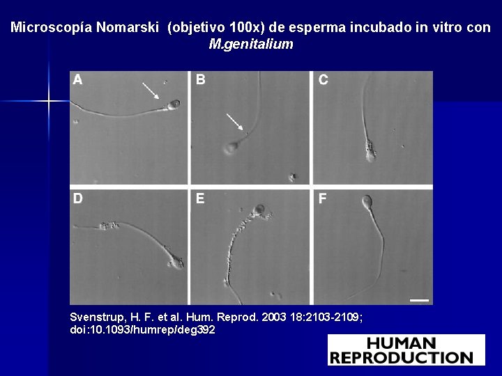 Microscopía Nomarski (objetivo 100 x) de esperma incubado in vitro con M. genitalium Svenstrup,