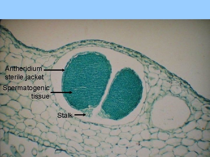 Antheridium sterile jacket Spermatogenic tissue Stalk 