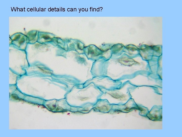 What cellular details can you find? 