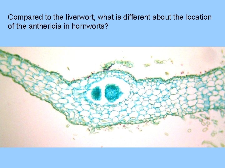 Compared to the liverwort, what is different about the location of the antheridia in