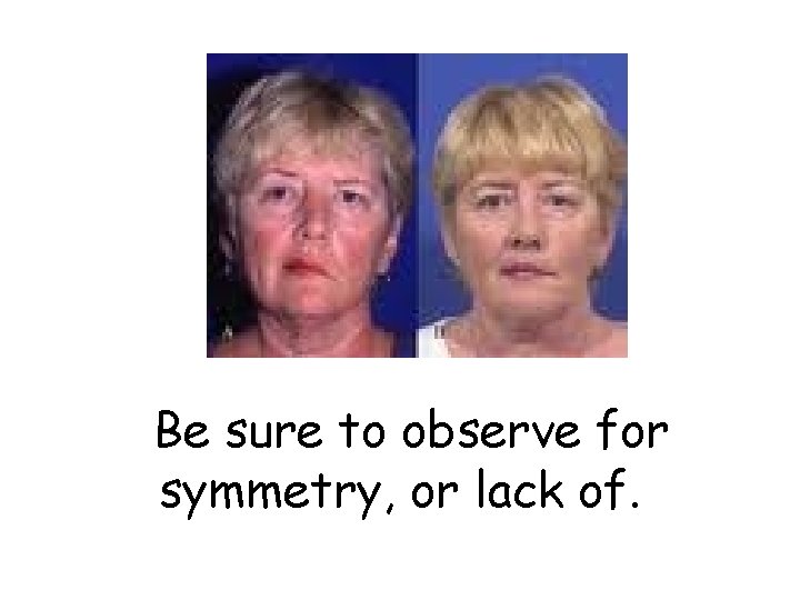 Be sure to observe for symmetry, or lack of. 