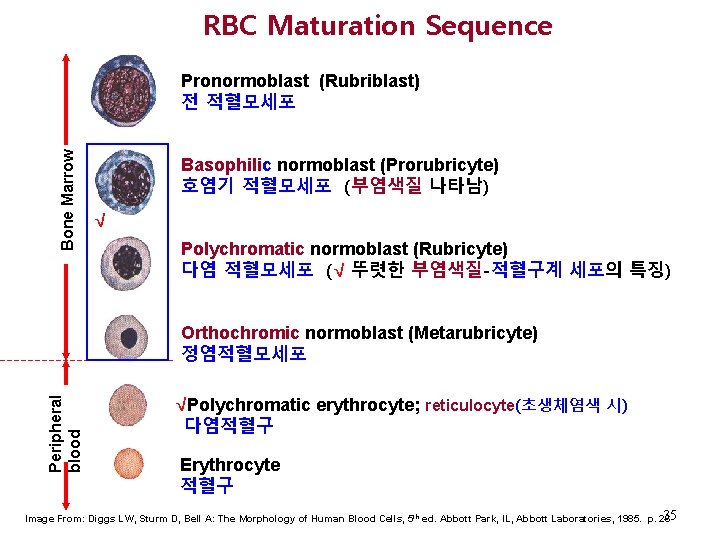 RBC Maturation Sequence Bone Marrow Pronormoblast (Rubriblast) 전 적혈모세포 Basophilic normoblast (Prorubricyte) 호염기 적혈모세포