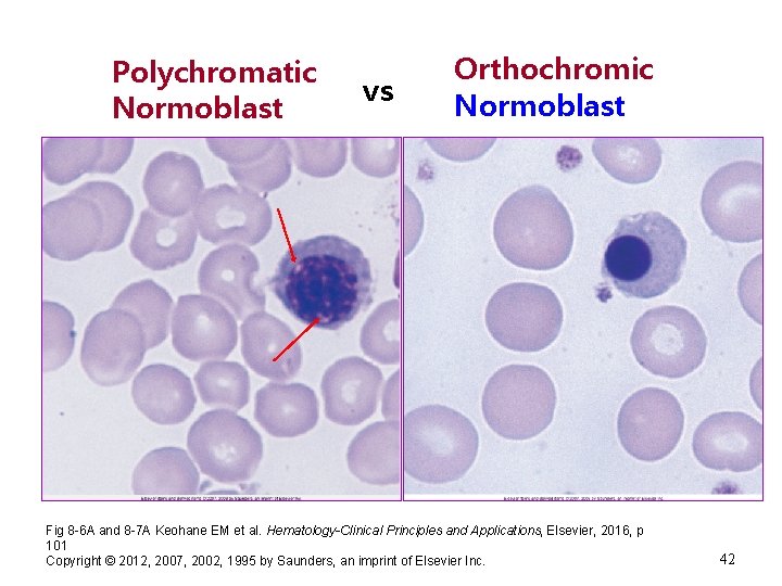 Polychromatic Normoblast vs Orthochromic Normoblast Fig 8 -6 A and 8 -7 A Keohane