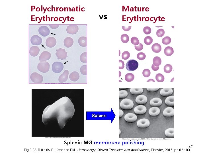 Polychromatic Erythrocyte vs Mature Erythrocyte Spleen Splenic MØ membrane polishing 47 Fig 8 -8