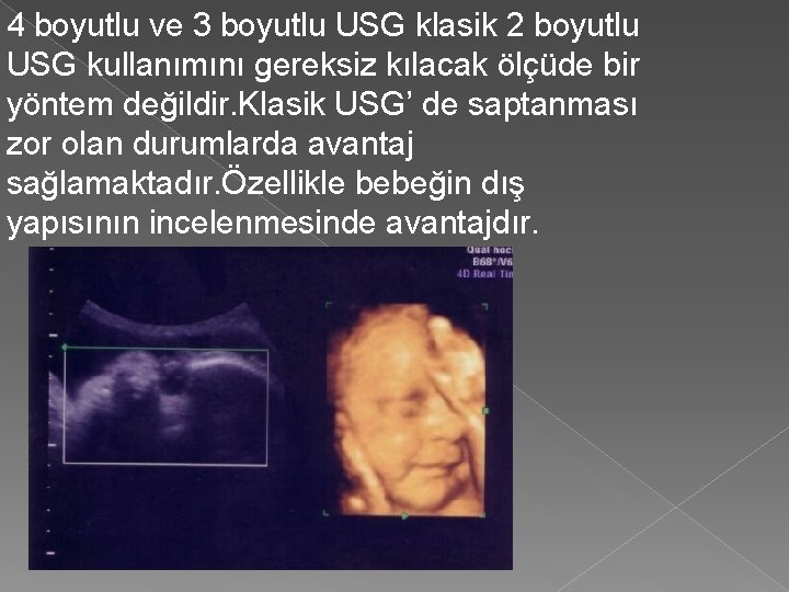 4 boyutlu ve 3 boyutlu USG klasik 2 boyutlu USG kullanımını gereksiz kılacak ölçüde