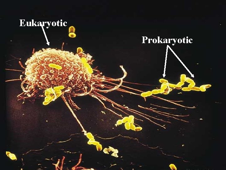 Eukaryotic Prokaryotic 