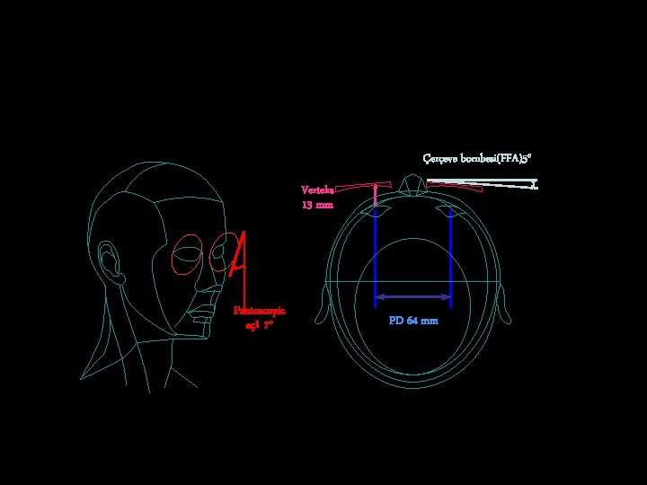 Standart Değerler Çerçeve bombesi(FFA)5° Verteks 13 mm Pantoscopic açı 7° PD 64 mm 
