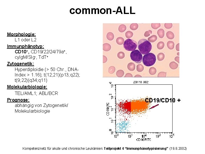 common-ALL Morphologie: L 1 oder L 2 Immunphänotyp: CD 10+, CD 19/22/24/79 a+, cy.
