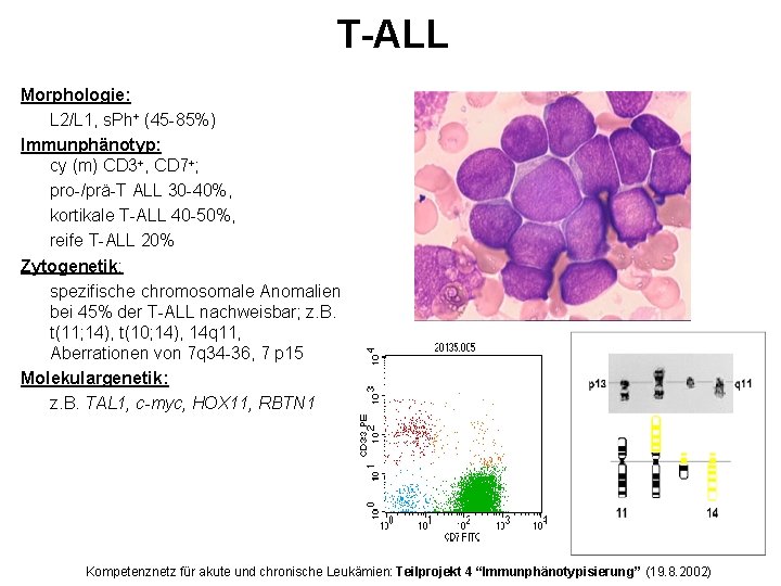 T-ALL Morphologie: L 2/L 1, s. Ph+ (45 -85%) Immunphänotyp: cy (m) CD 3+,