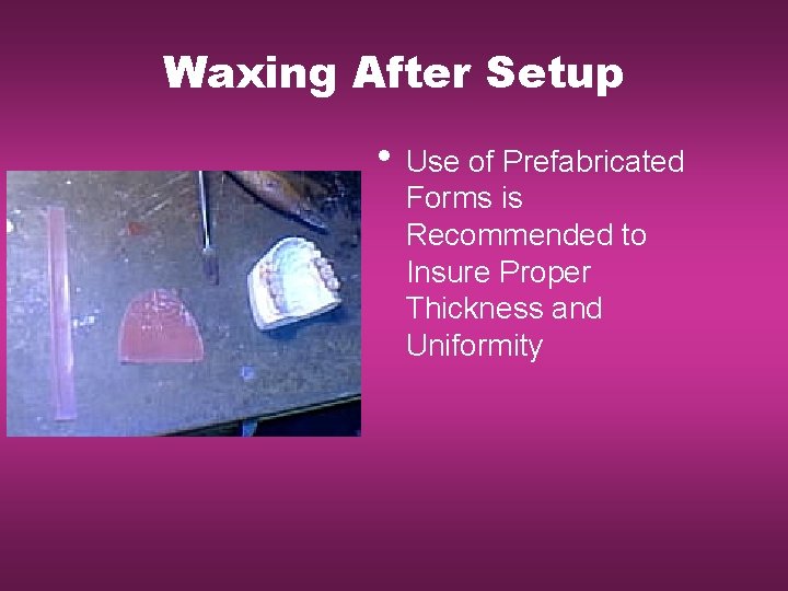 Waxing After Setup • Use of Prefabricated Forms is Recommended to Insure Proper Thickness