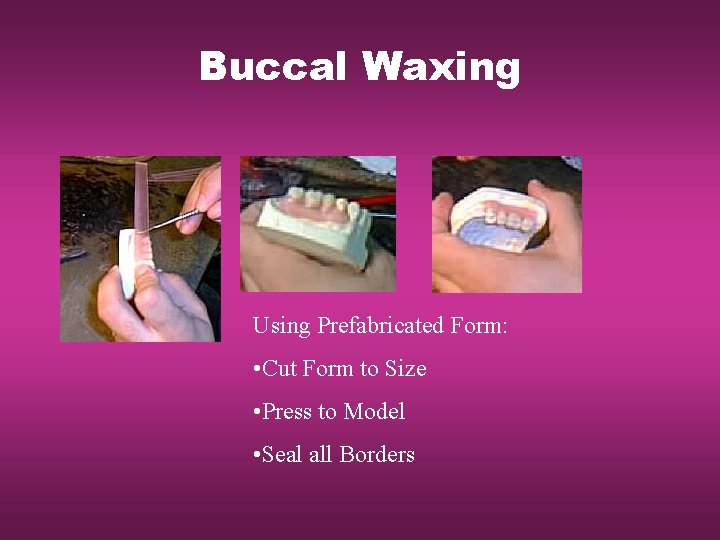 Buccal Waxing Using Prefabricated Form: • Cut Form to Size • Press to Model