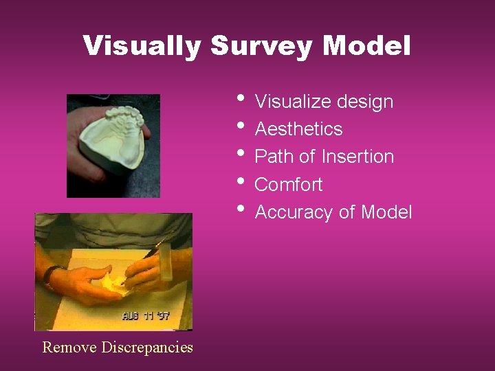 Visually Survey Model • Visualize design • Aesthetics • Path of Insertion • Comfort