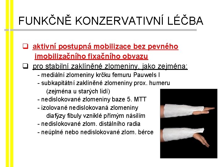 FUNKČNĚ KONZERVATIVNÍ LÉČBA q aktivní postupná mobilizace bez pevného imobilizačního fixačního obvazu q pro