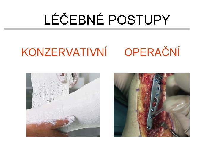 LÉČEBNÉ POSTUPY KONZERVATIVNÍ OPERAČNÍ 