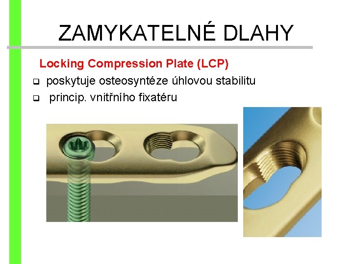 ZAMYKATELNÉ DLAHY Locking Compression Plate (LCP) q poskytuje osteosyntéze úhlovou stabilitu q princip. vnitřního