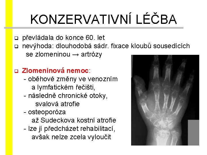 KONZERVATIVNÍ LÉČBA převládala do konce 60. let q nevýhoda: dlouhodobá sádr. fixace kloubů sousedících