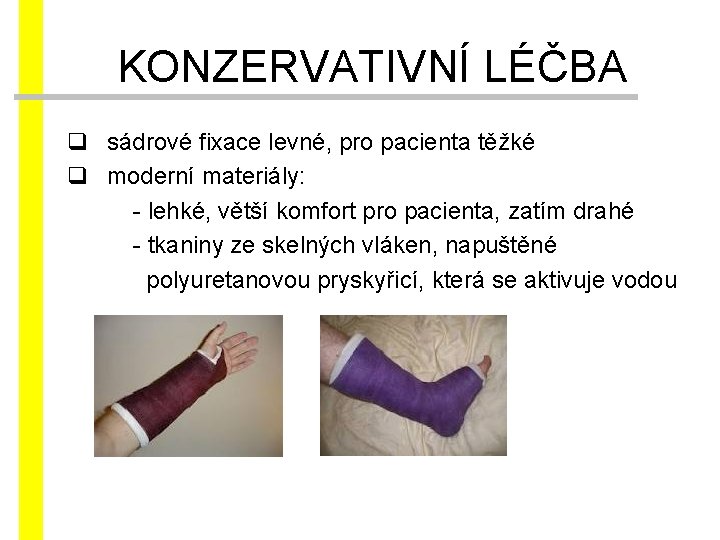 KONZERVATIVNÍ LÉČBA q sádrové fixace levné, pro pacienta těžké q moderní materiály: - lehké,