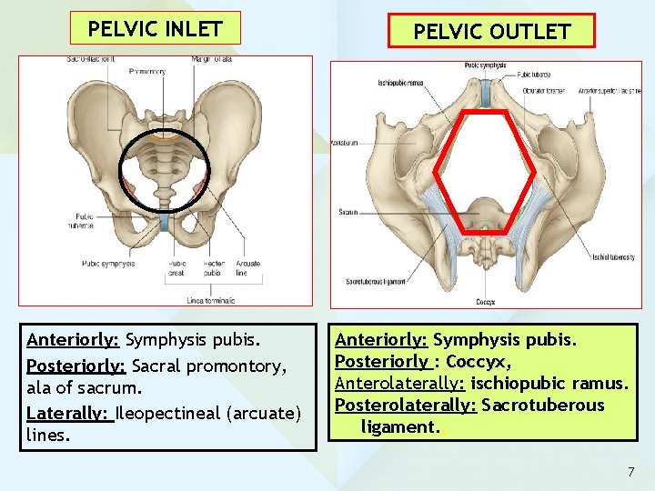 PELVIC INLET Anteriorly: Symphysis pubis. Posteriorly: Sacral promontory, ala of sacrum. Laterally: Ileopectineal (arcuate)