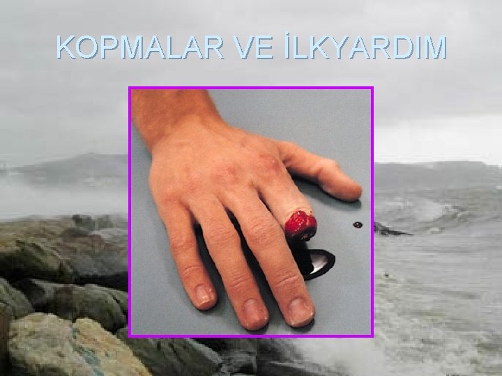 KOPMALAR VE İLKYARDIM 