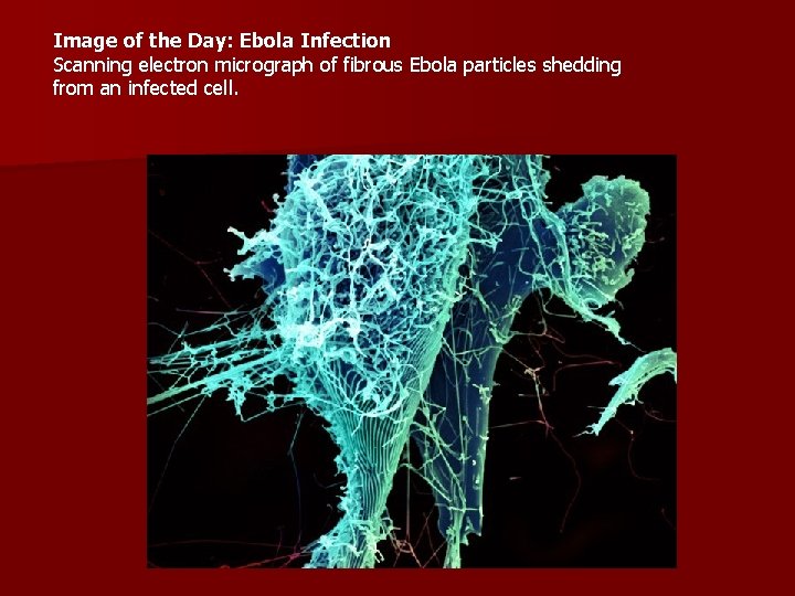 Image of the Day: Ebola Infection Scanning electron micrograph of fibrous Ebola particles shedding