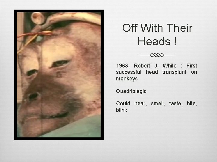 Off With Their Heads ! 1963, Robert J. White : First successful head transplant