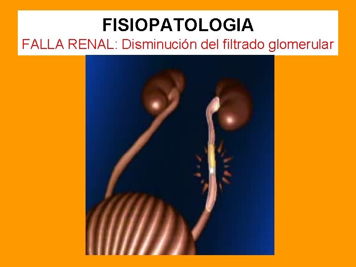FISIOPATOLOGIA FALLA RENAL: Disminución del filtrado glomerular 