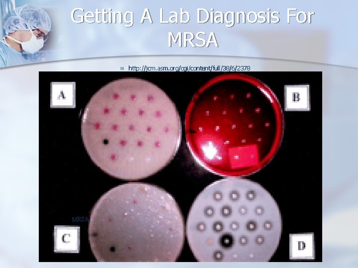 Getting A Lab Diagnosis For MRSA n MRSA http: //jcm. asm. org/cgi/content/full/38/6/2378 