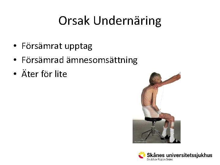 Orsak Undernäring • Försämrat upptag • Försämrad ämnesomsättning • Äter för lite 