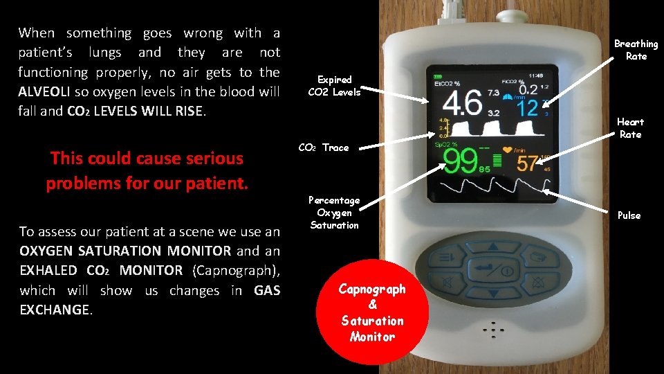 When something goes wrong with a patient’s lungs and they are not functioning properly,