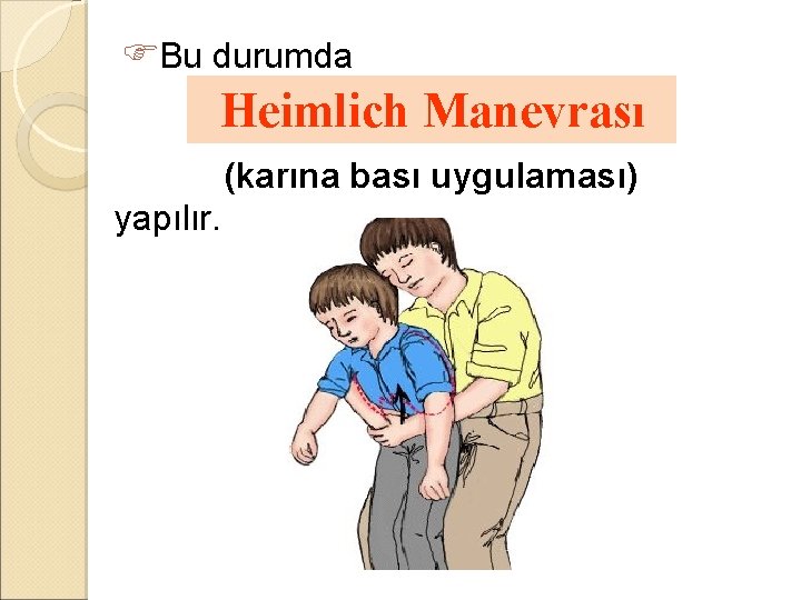  Bu durumda Heimlich Manevrası (karına bası uygulaması) yapılır. 